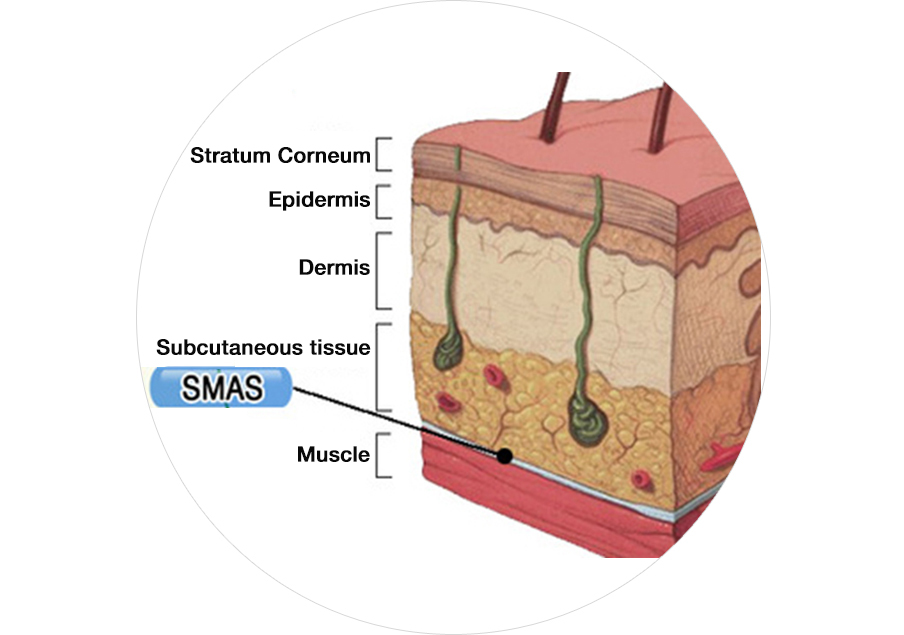 피부와 SMAS층을 동시에 개선하는 피부층 사진