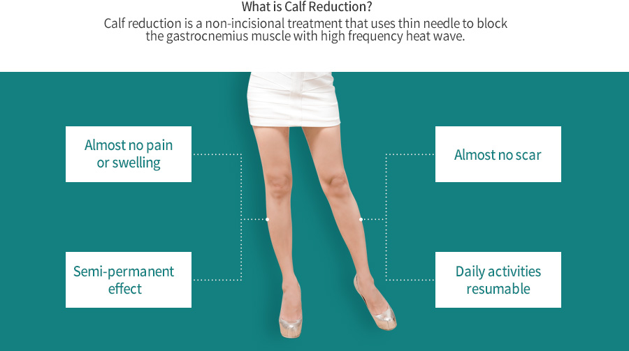 What is Calf Reduction? Calf reduction is a non-incisional treatment that uses thin needle to block the gastrocnemius muscle with high frequency heat wave.