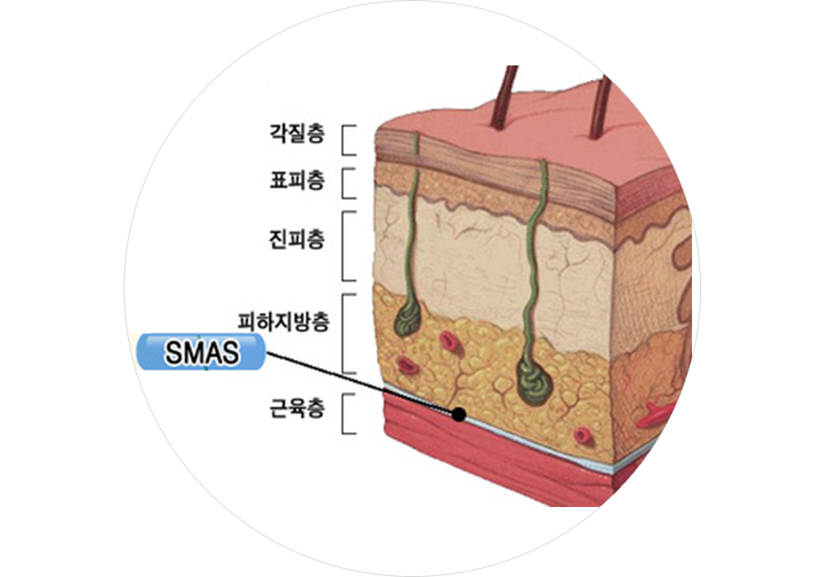 피부와 SMAS층을 동시에 개선하는 피부층 사진